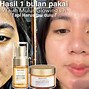 Serum Retinol G2G Berapa Persen